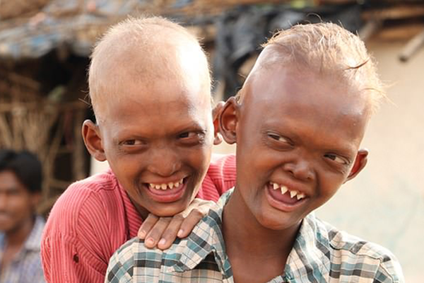 立昂技术：截{至}2{0}25年11月28日公司总户数为43355户